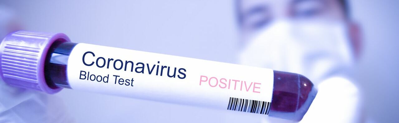 coronavirus