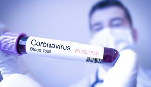 Coronavirus